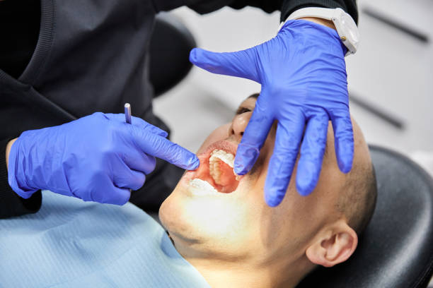 Best Urgent Tooth Repair  in Rothsville, PA