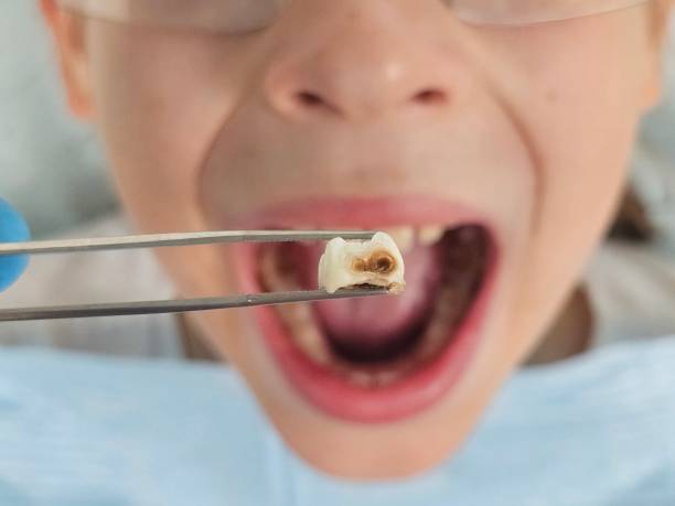 Best Emergency Dental Filling Replacement  in Rothsville, PA
